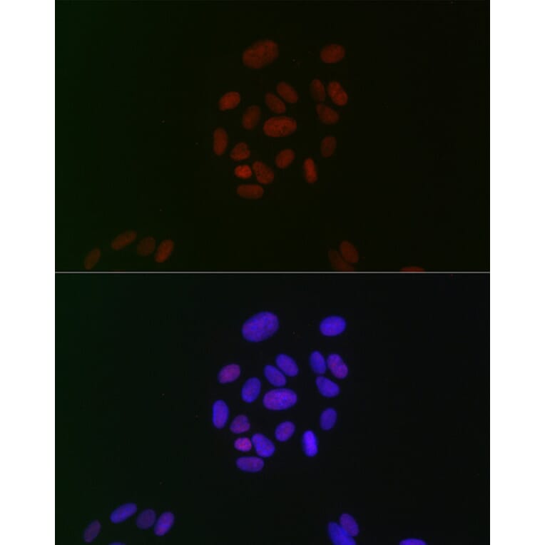 Immunofluorescence - Anti-CIRP Antibody [ARC2472] (A307005) - Antibodies.com