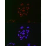 Immunofluorescence - Anti-CIRP Antibody [ARC2472] (A307005) - Antibodies.com