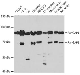 Western Blot - Anti-RanGAP1 Antibody [ARC1292] (A307006) - Antibodies.com