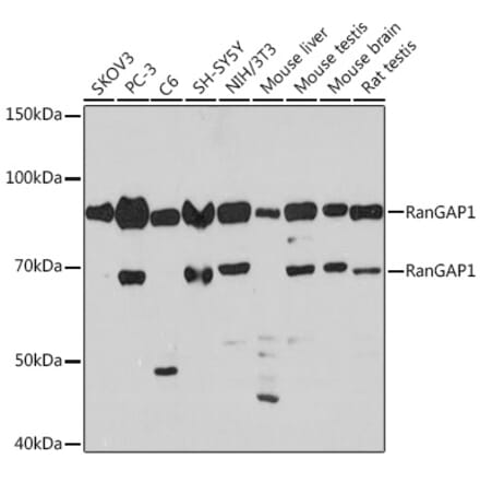 Western Blot - Anti-RanGAP1 Antibody [ARC1292] (A307006) - Antibodies.com