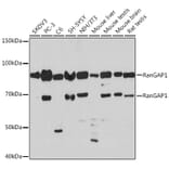 Western Blot - Anti-RanGAP1 Antibody [ARC1292] (A307006) - Antibodies.com