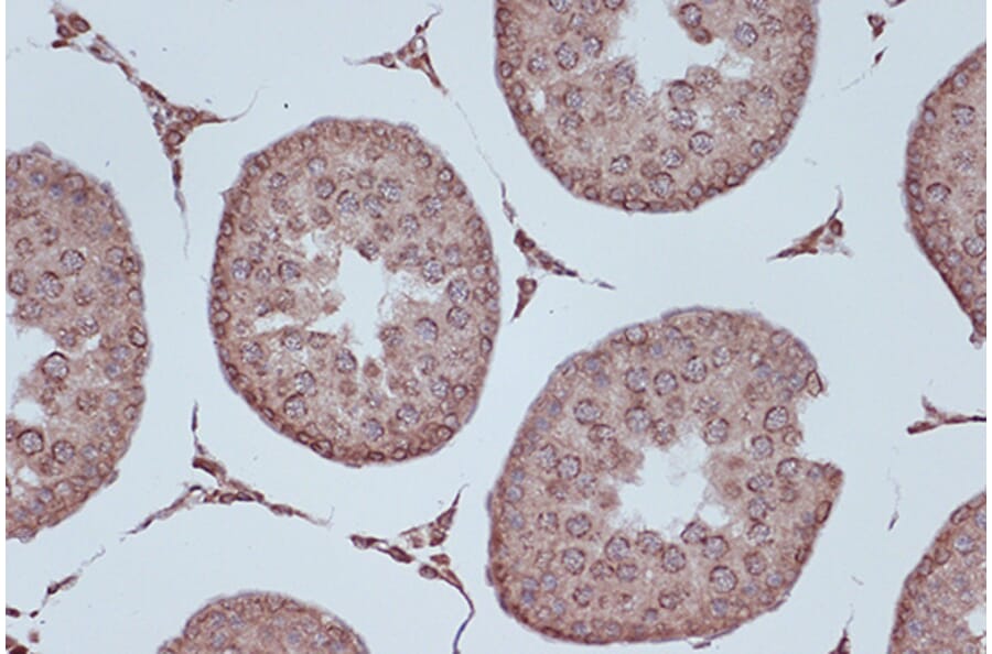 Immunohistochemistry - Anti-RanGAP1 Antibody [ARC1292] (A307006) - Antibodies.com