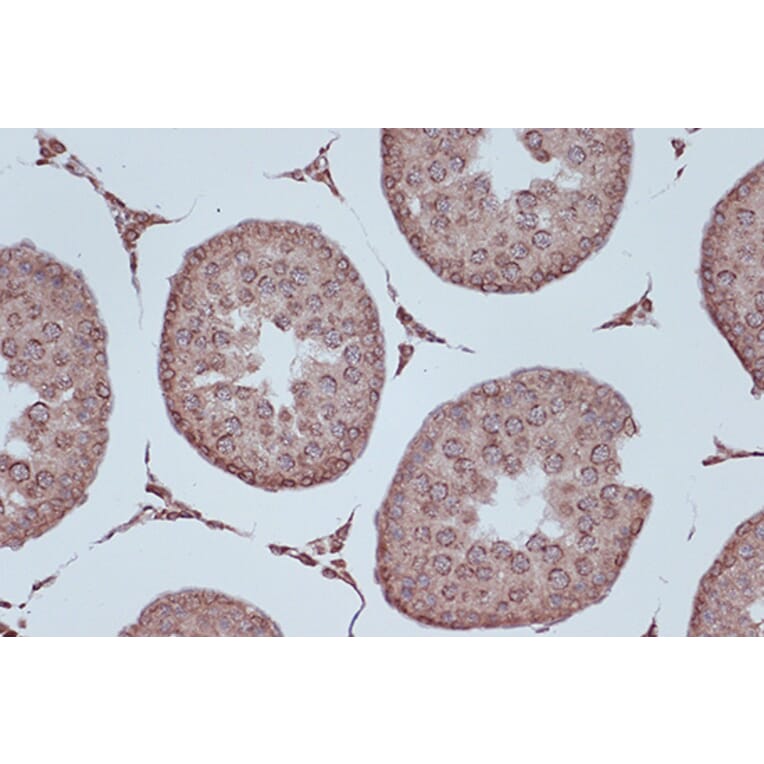 Immunohistochemistry - Anti-RanGAP1 Antibody [ARC1292] (A307006) - Antibodies.com
