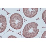 Immunohistochemistry - Anti-RanGAP1 Antibody [ARC1292] (A307006) - Antibodies.com