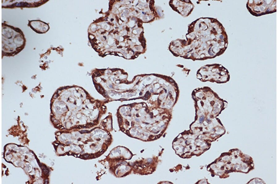 Immunohistochemistry - Anti-RanGAP1 Antibody [ARC1292] (A307006) - Antibodies.com