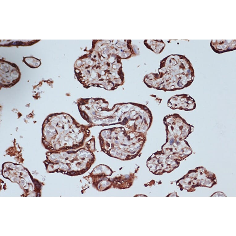 Immunohistochemistry - Anti-RanGAP1 Antibody [ARC1292] (A307006) - Antibodies.com