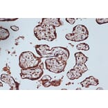 Immunohistochemistry - Anti-RanGAP1 Antibody [ARC1292] (A307006) - Antibodies.com