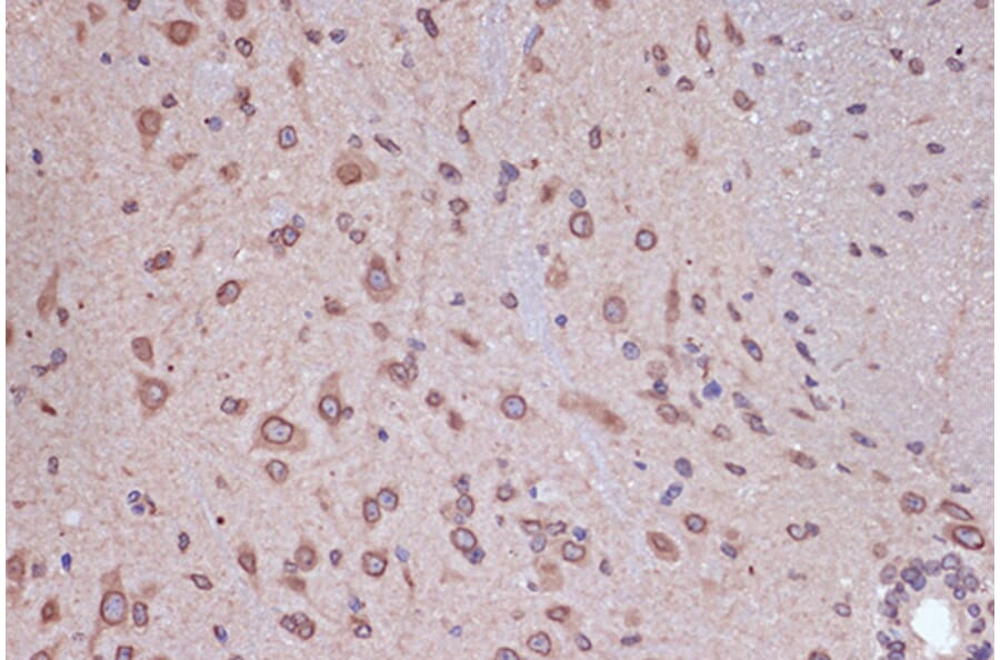 Immunohistochemistry - Anti-RanGAP1 Antibody [ARC1292] (A307006) - Antibodies.com