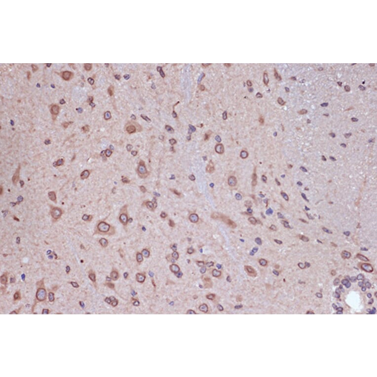 Immunohistochemistry - Anti-RanGAP1 Antibody [ARC1292] (A307006) - Antibodies.com