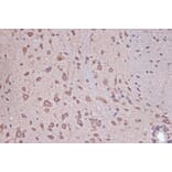 Immunohistochemistry - Anti-RanGAP1 Antibody [ARC1292] (A307006) - Antibodies.com
