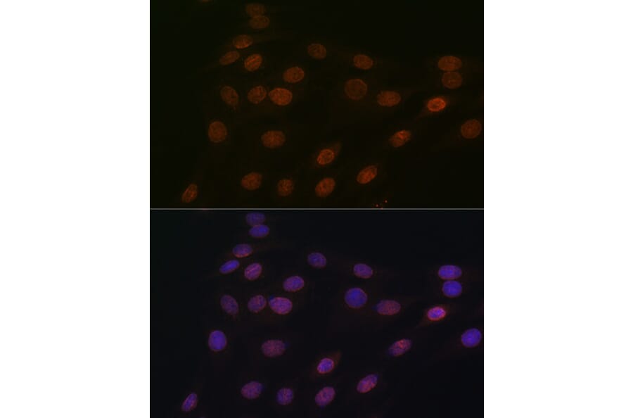 Immunofluorescence - Anti-RanGAP1 Antibody [ARC1292] (A307006) - Antibodies.com