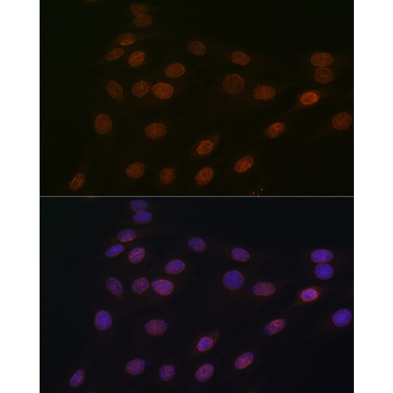Immunofluorescence - Anti-RanGAP1 Antibody [ARC1292] (A307006) - Antibodies.com