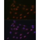 Immunofluorescence - Anti-RanGAP1 Antibody [ARC1292] (A307006) - Antibodies.com