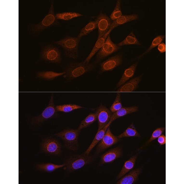 Immunofluorescence - Anti-RanGAP1 Antibody [ARC1292] (A307006) - Antibodies.com