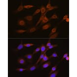 Immunofluorescence - Anti-RanGAP1 Antibody [ARC1292] (A307006) - Antibodies.com