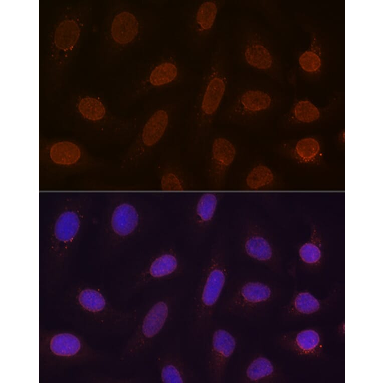 Immunofluorescence - Anti-RanGAP1 Antibody [ARC1292] (A307006) - Antibodies.com