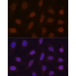 Immunofluorescence - Anti-RanGAP1 Antibody [ARC1292] (A307006) - Antibodies.com