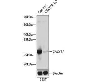 Western Blot - Anti-CacyBP Antibody (A307007) - Antibodies.com