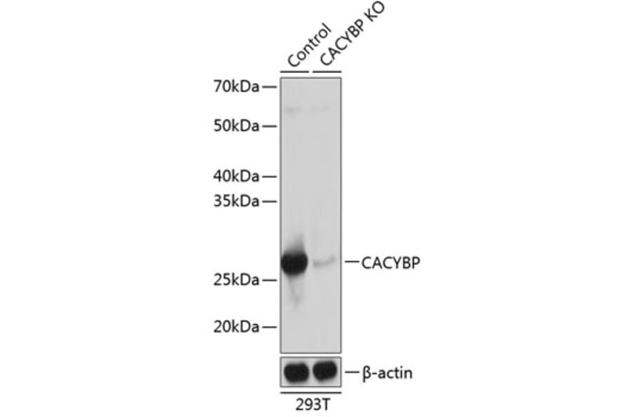 Western Blot - Anti-CacyBP Antibody (A307007) - Antibodies.com