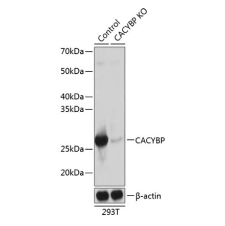 Western Blot - Anti-CacyBP Antibody (A307007) - Antibodies.com