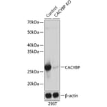 Western Blot - Anti-CacyBP Antibody (A307007) - Antibodies.com