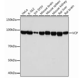 Western Blot - Anti-VCP Antibody [ARC0728] (A307008) - Antibodies.com