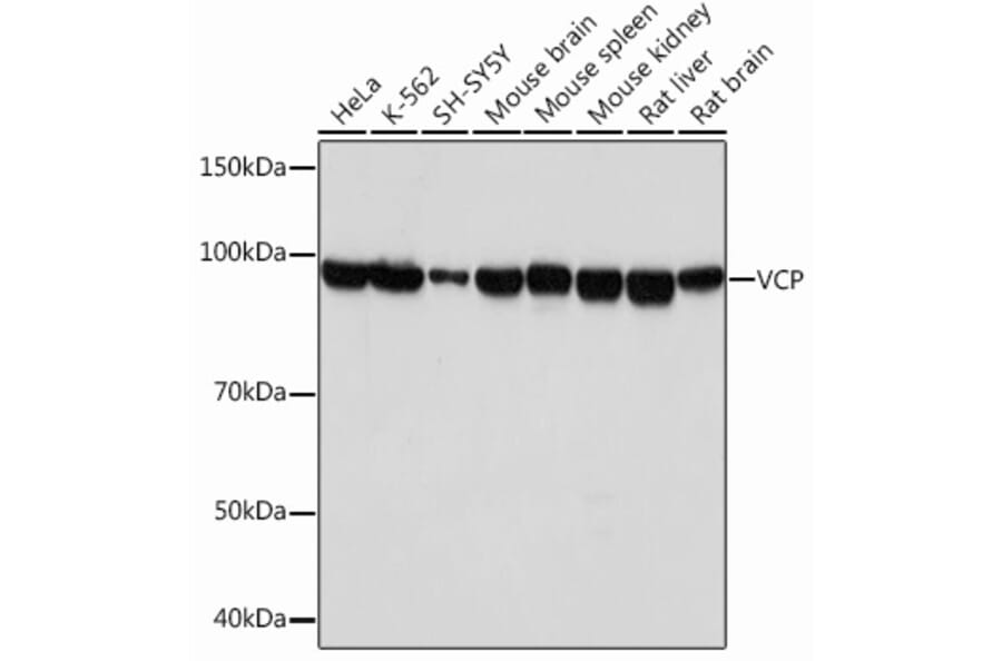 Western Blot - Anti-VCP Antibody [ARC0728] (A307008) - Antibodies.com