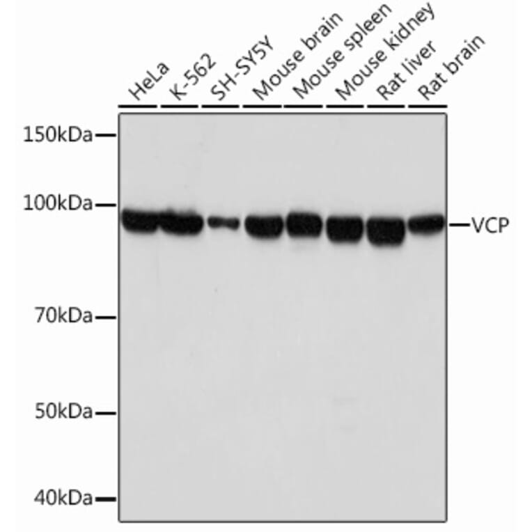 Western Blot - Anti-VCP Antibody [ARC0728] (A307008) - Antibodies.com