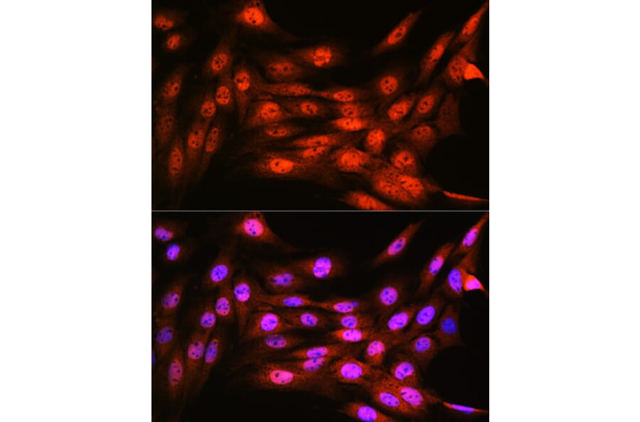 Immunofluorescence - Anti-VCP Antibody [ARC0728] (A307008) - Antibodies.com