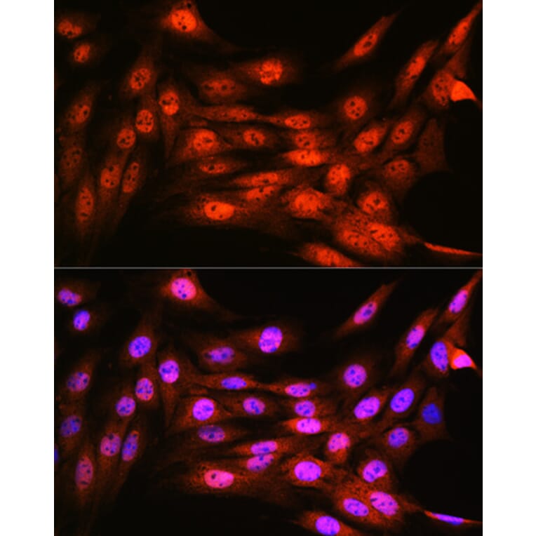 Immunofluorescence - Anti-VCP Antibody [ARC0728] (A307008) - Antibodies.com