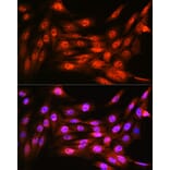 Immunofluorescence - Anti-VCP Antibody [ARC0728] (A307008) - Antibodies.com