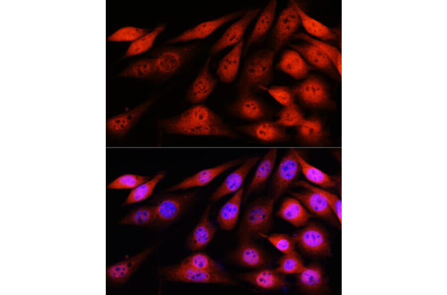 Immunofluorescence - Anti-VCP Antibody [ARC0728] (A307008) - Antibodies.com