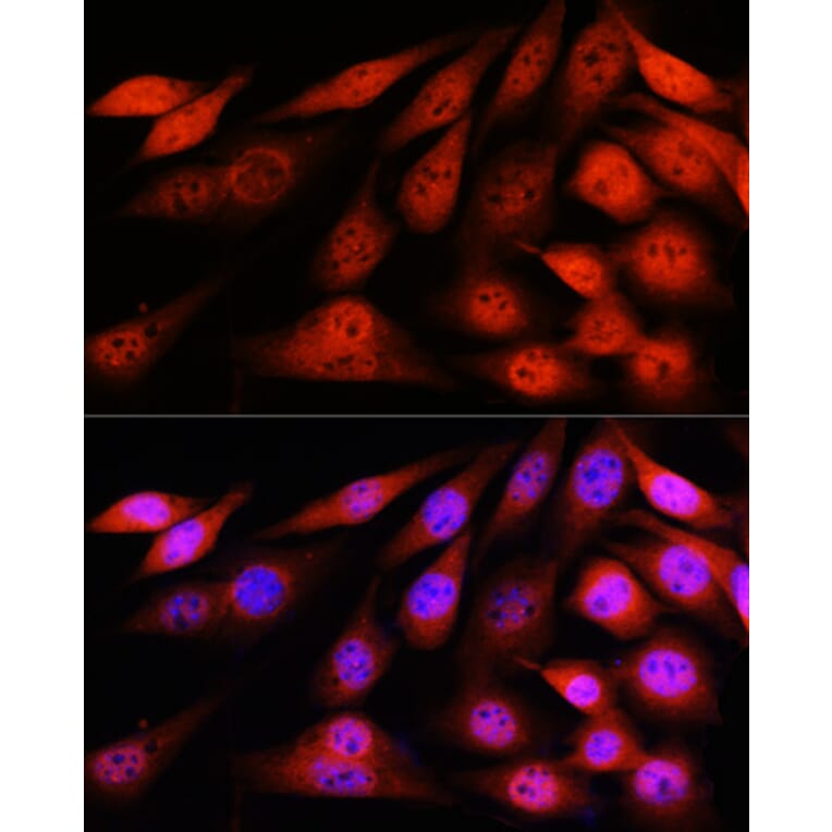 Immunofluorescence - Anti-VCP Antibody [ARC0728] (A307008) - Antibodies.com