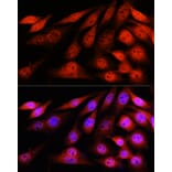 Immunofluorescence - Anti-VCP Antibody [ARC0728] (A307008) - Antibodies.com