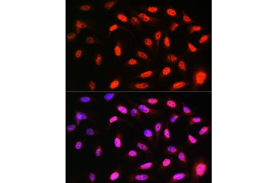 Immunofluorescence - Anti-VCP Antibody [ARC0728] (A307008) - Antibodies.com