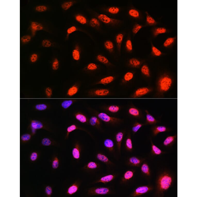 Immunofluorescence - Anti-VCP Antibody [ARC0728] (A307008) - Antibodies.com