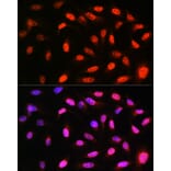 Immunofluorescence - Anti-VCP Antibody [ARC0728] (A307008) - Antibodies.com