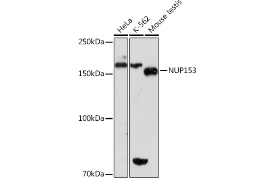 Western Blot - Anti-Nup153 Antibody [ARC1922] (A307009) - Antibodies.com