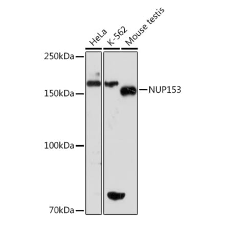 Western Blot - Anti-Nup153 Antibody [ARC1922] (A307009) - Antibodies.com