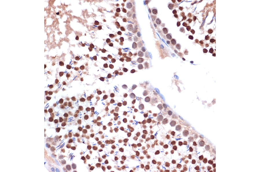 Immunohistochemistry - Anti-Nup153 Antibody [ARC1922] (A307009) - Antibodies.com