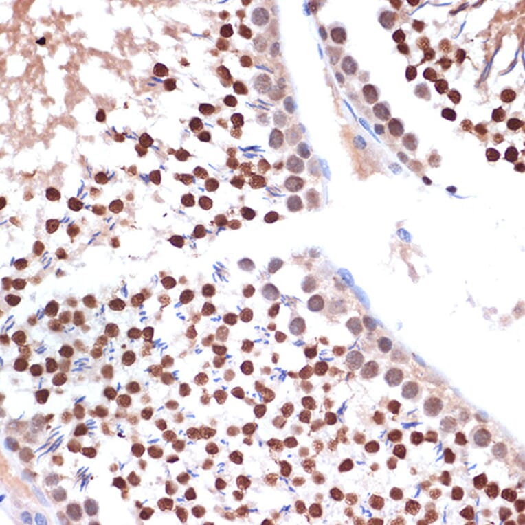 Immunohistochemistry - Anti-Nup153 Antibody [ARC1922] (A307009) - Antibodies.com