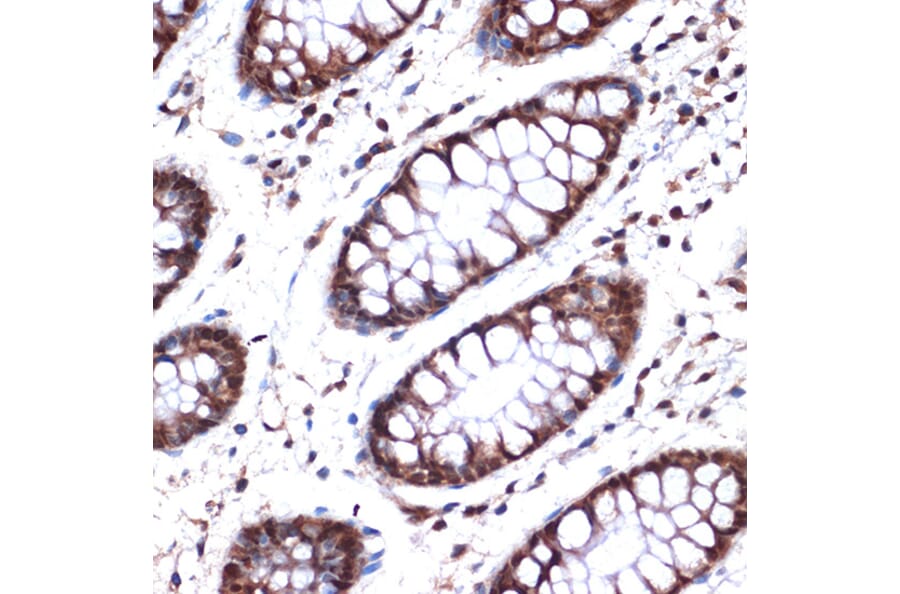 Immunohistochemistry - Anti-Nup153 Antibody [ARC1922] (A307009) - Antibodies.com