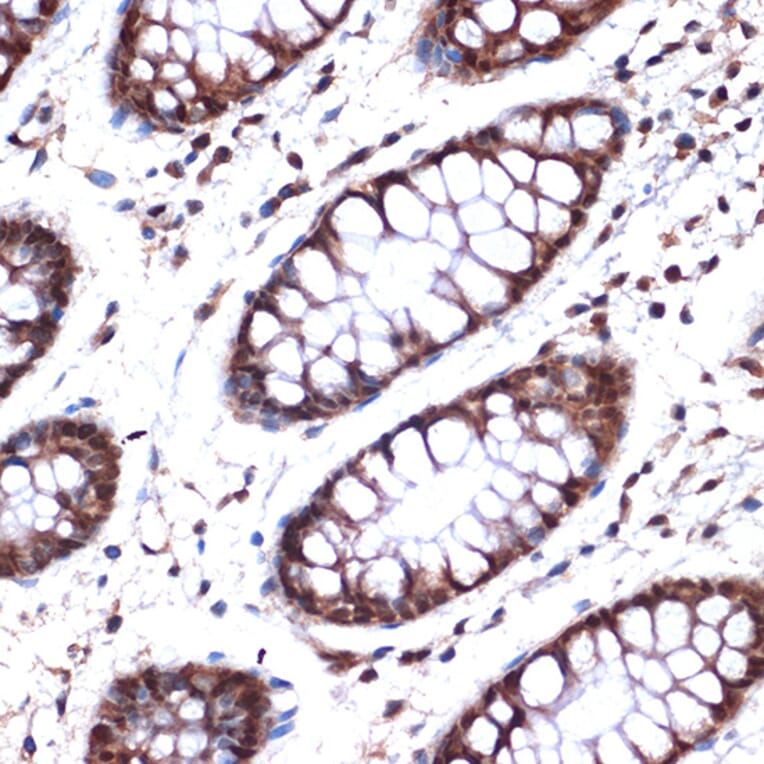 Immunohistochemistry - Anti-Nup153 Antibody [ARC1922] (A307009) - Antibodies.com