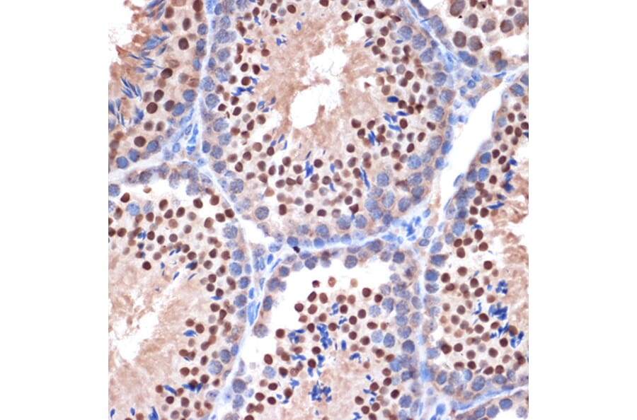 Immunohistochemistry - Anti-Nup153 Antibody [ARC1922] (A307009) - Antibodies.com