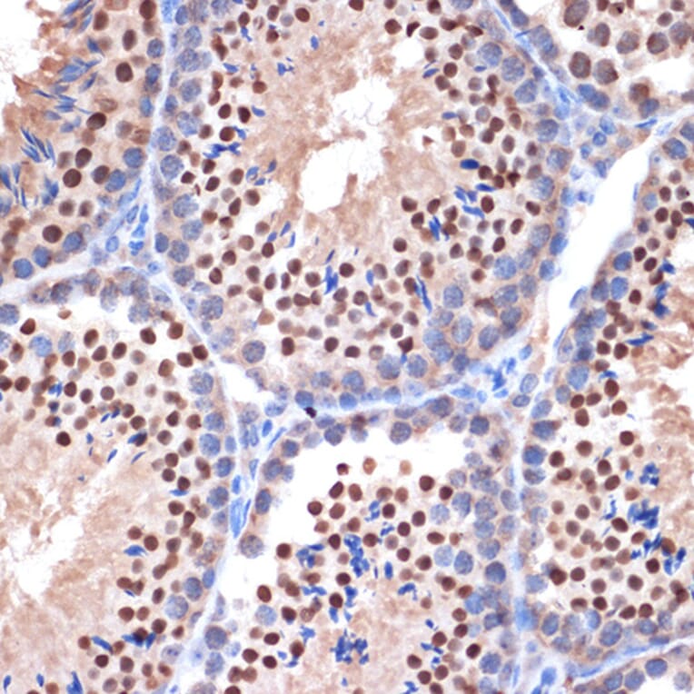 Immunohistochemistry - Anti-Nup153 Antibody [ARC1922] (A307009) - Antibodies.com