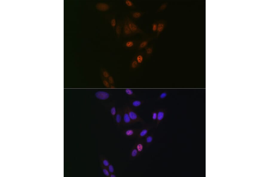 Immunofluorescence - Anti-Nup153 Antibody [ARC1922] (A307009) - Antibodies.com
