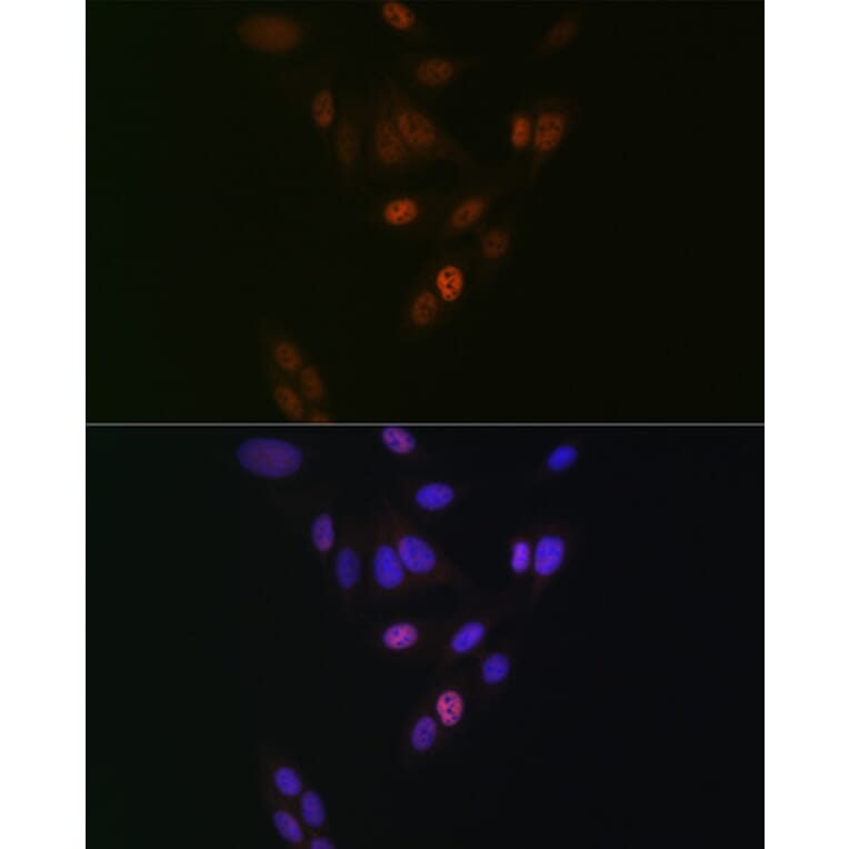 Immunofluorescence - Anti-Nup153 Antibody [ARC1922] (A307009) - Antibodies.com