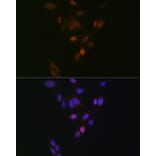 Immunofluorescence - Anti-Nup153 Antibody [ARC1922] (A307009) - Antibodies.com