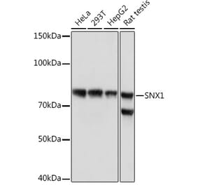 Western Blot - Anti-SNX1 Antibody [ARC1969] (A307010) - Antibodies.com