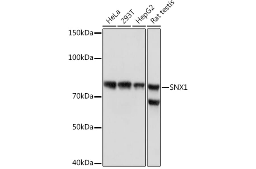 Western Blot - Anti-SNX1 Antibody [ARC1969] (A307010) - Antibodies.com